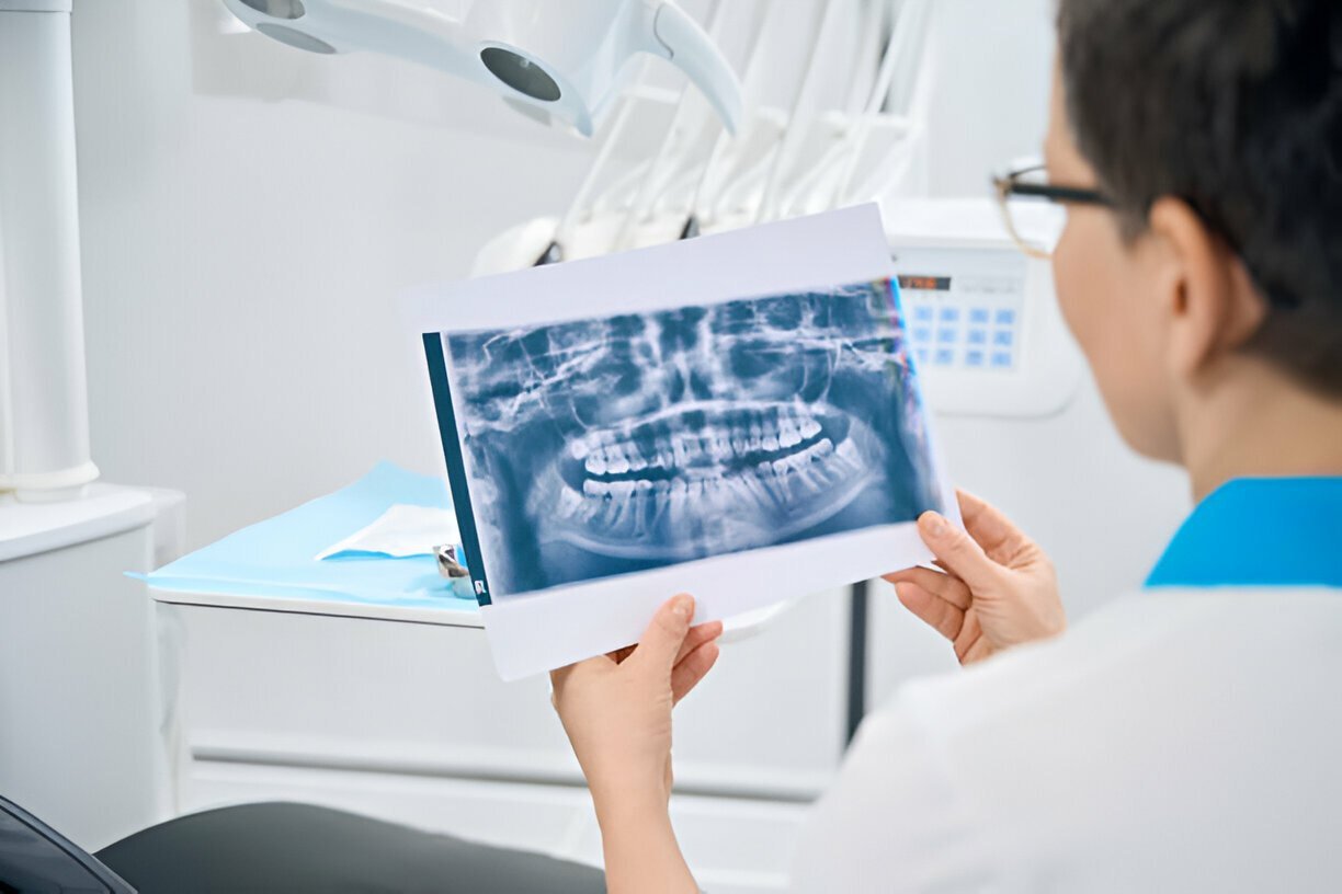 un parodontiste examine une image radiographique de la mâchoire d'un patient