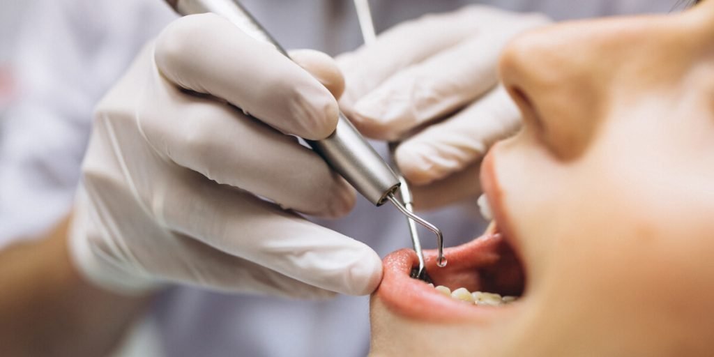 Des interventions dentaires qui aident à maintenir le parfait état des dents